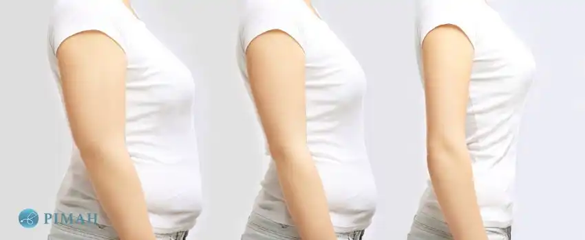 Weight loss program (9)