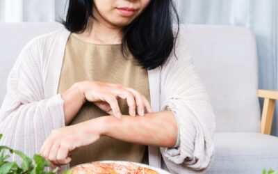 Frequent Hives After Meals: Understanding the Cause and Finding Relief